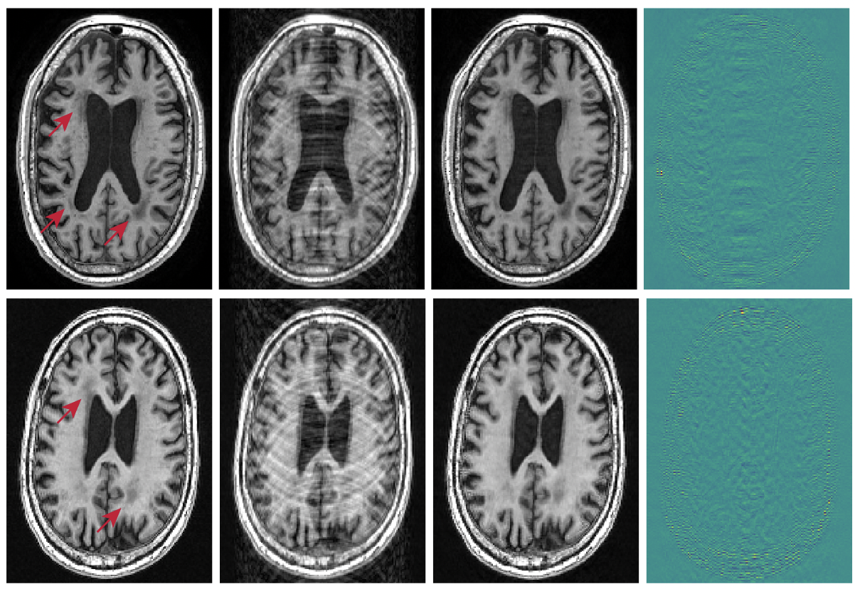 MR image reconstruction using deep density priors